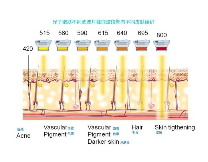 五大光子嫩膚技術(shù)（IPL、DPL、OPT、APT、BBL）及濾光片區(qū)別
