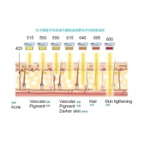 五大光子嫩膚技術（IPL、DPL、OPT、APT、BBL）及濾光片區(qū)別